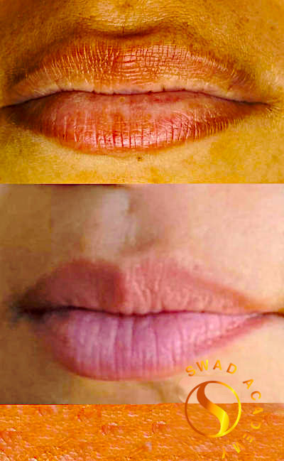 Lip Gloss