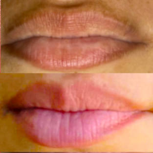 lips color correction