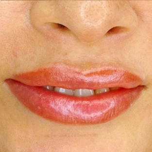 Lips Gloss Hydration